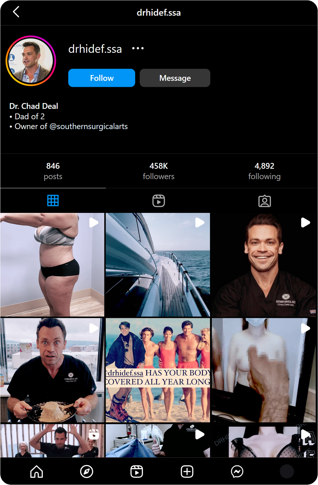 IG-Before-Chad