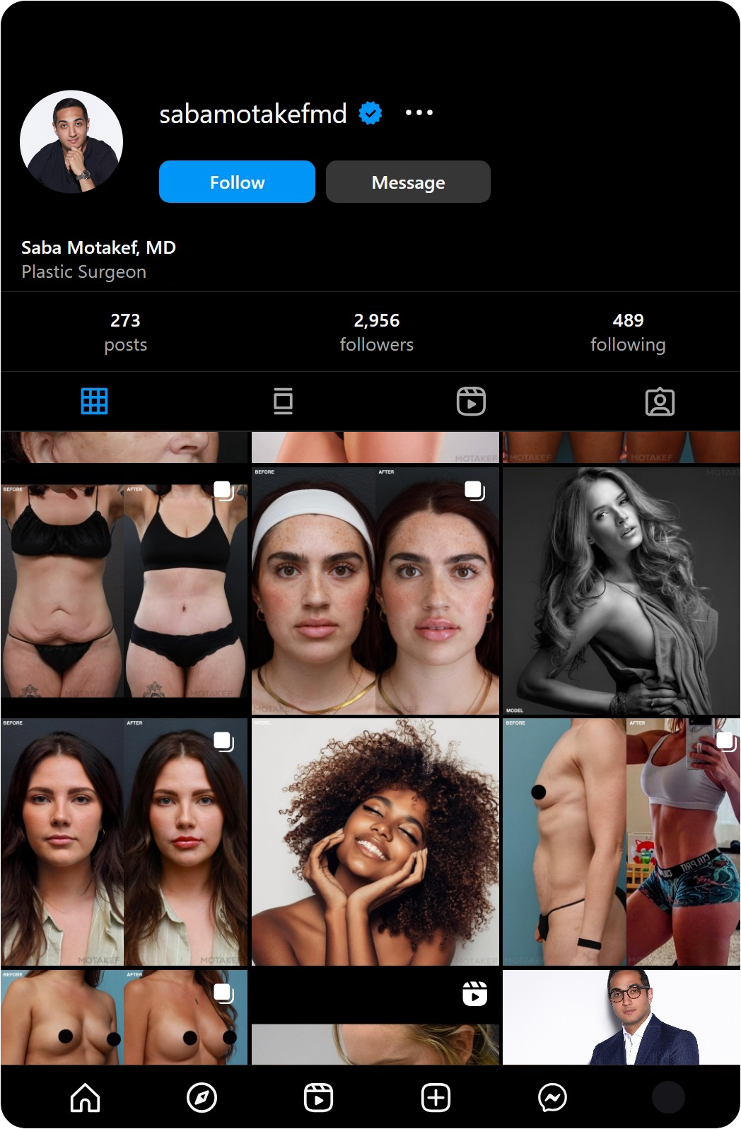Instagram Before Final