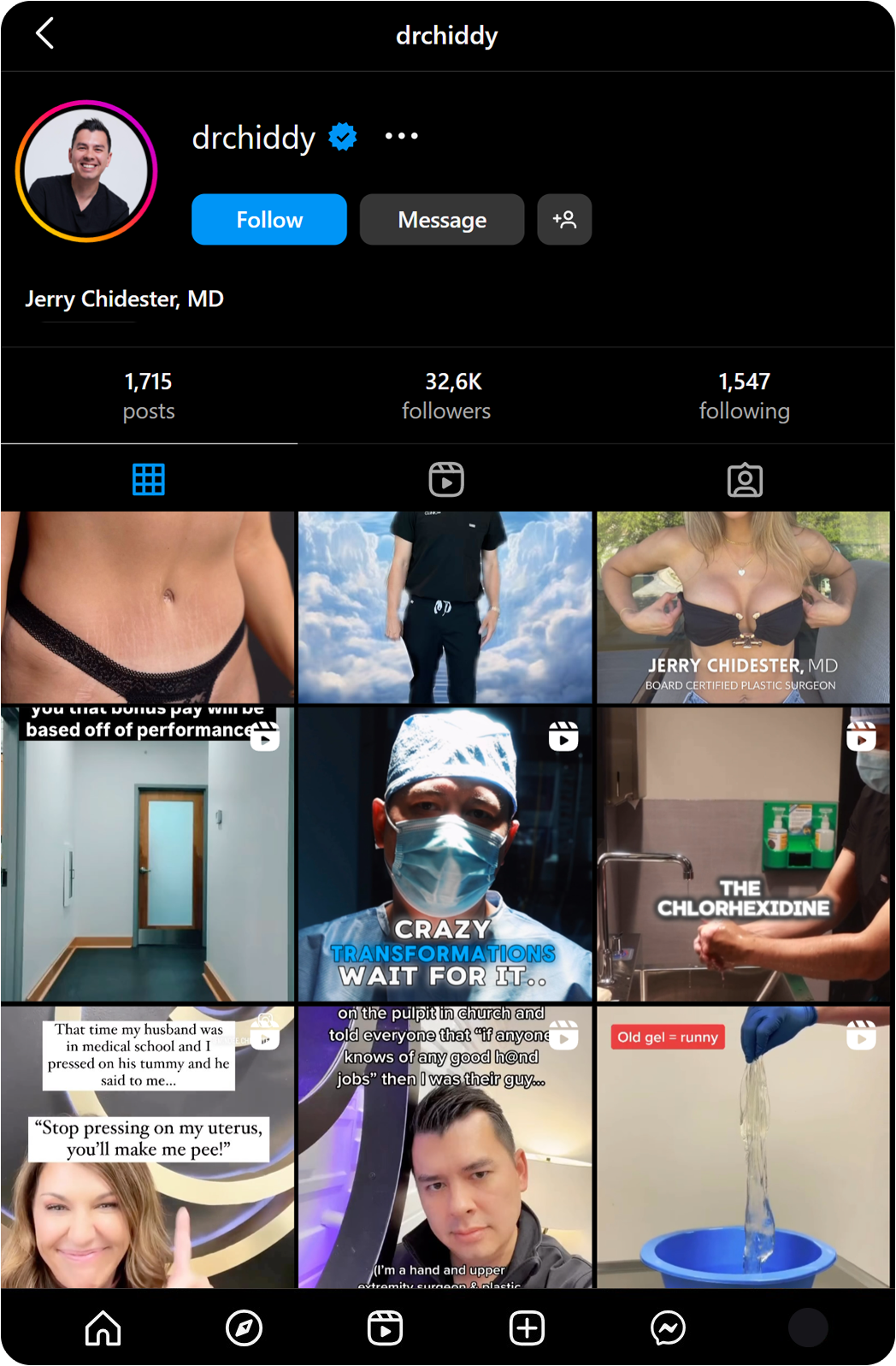 Instagram-Before